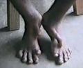 feet of local